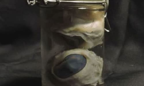 10-crazy-ways-to-cure-a-hangover