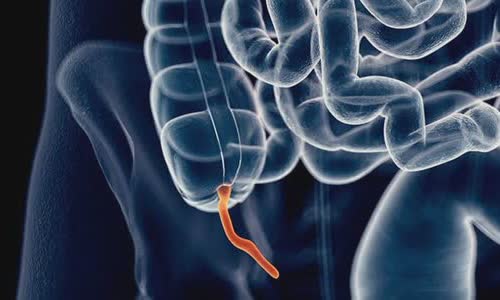 what-is-the-appendix