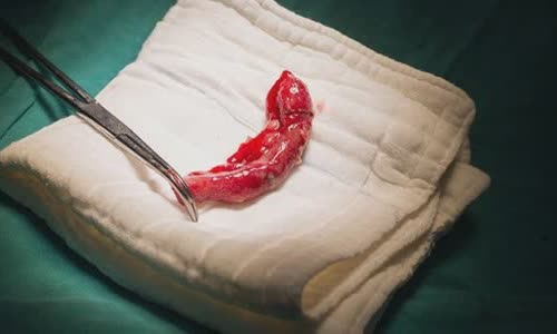 what-is-the-appendix