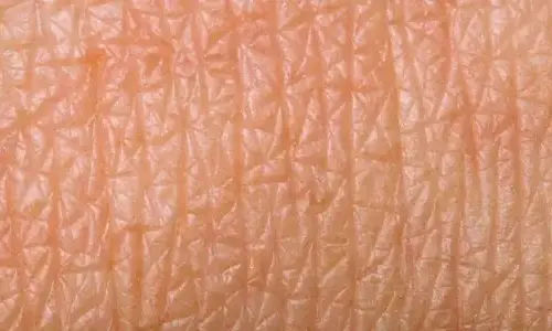 what-is-trypophobia