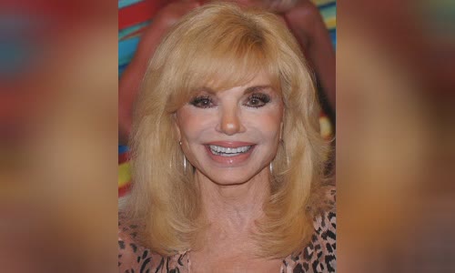 Loni Anderson