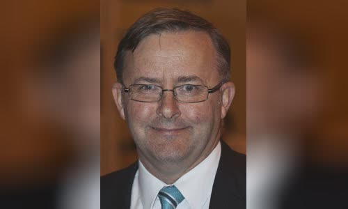 Anthony Albanese