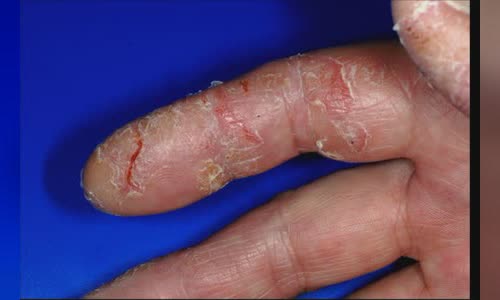 Disfigurement