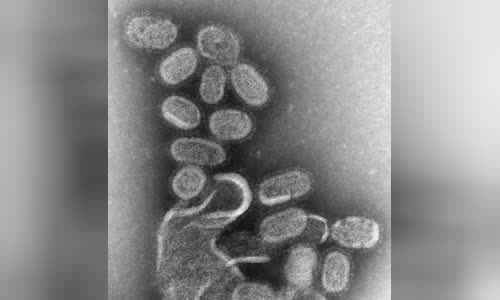 Influenza