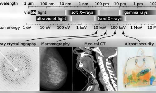 X-ray