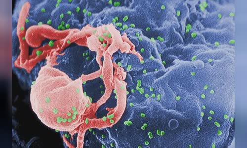 HIV