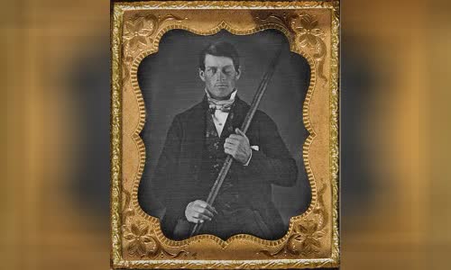 Phineas Gage