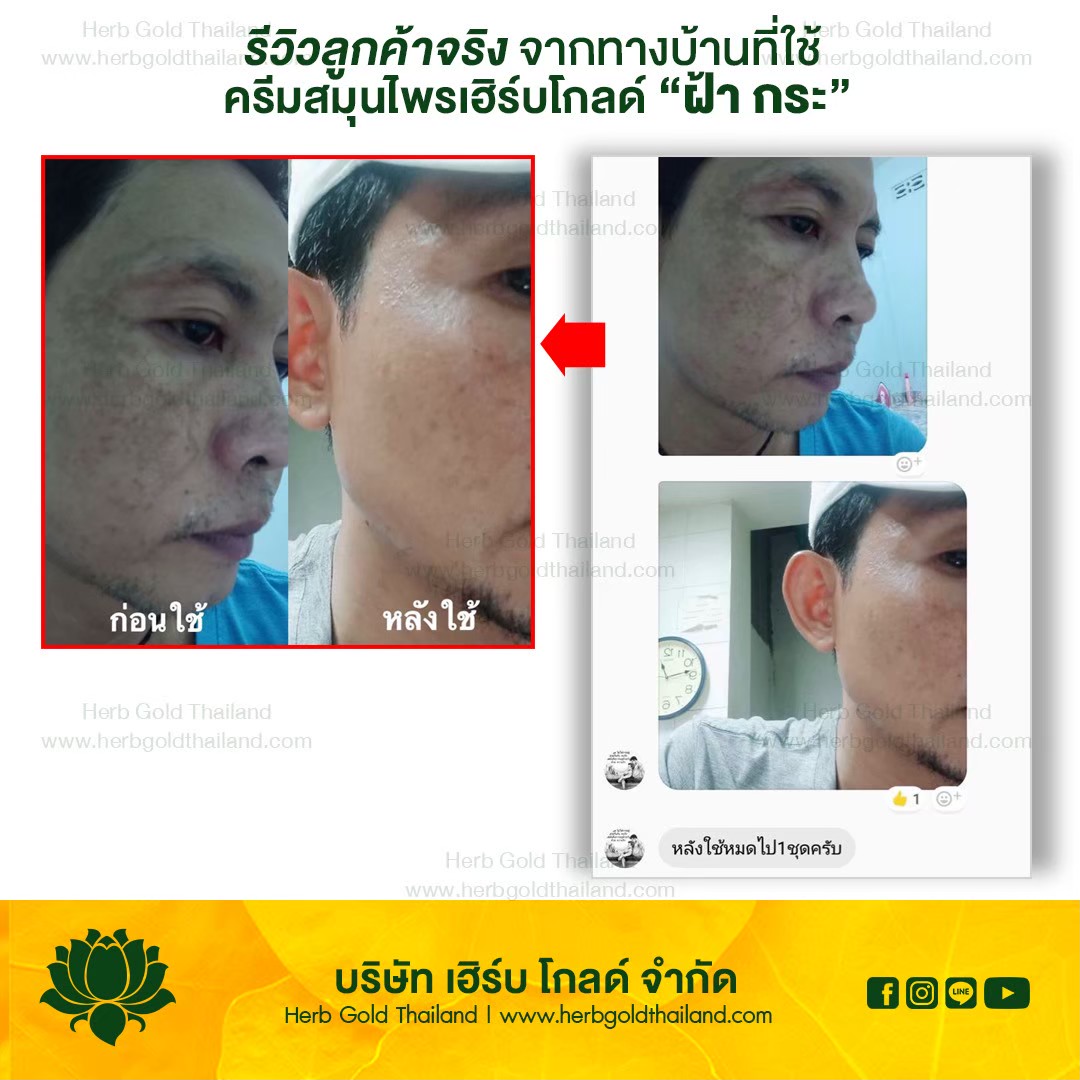 รูปเซลเพจ