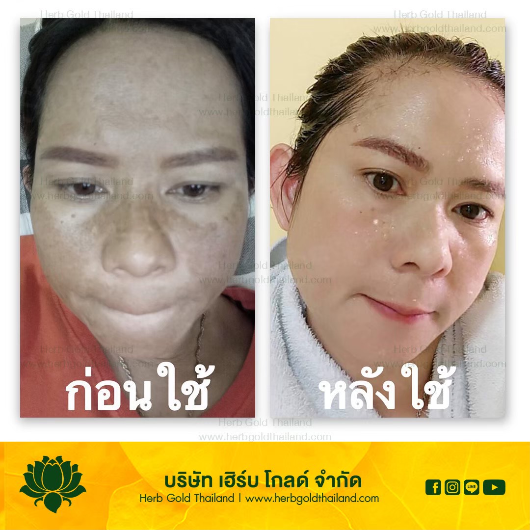 รูปเซลเพจ