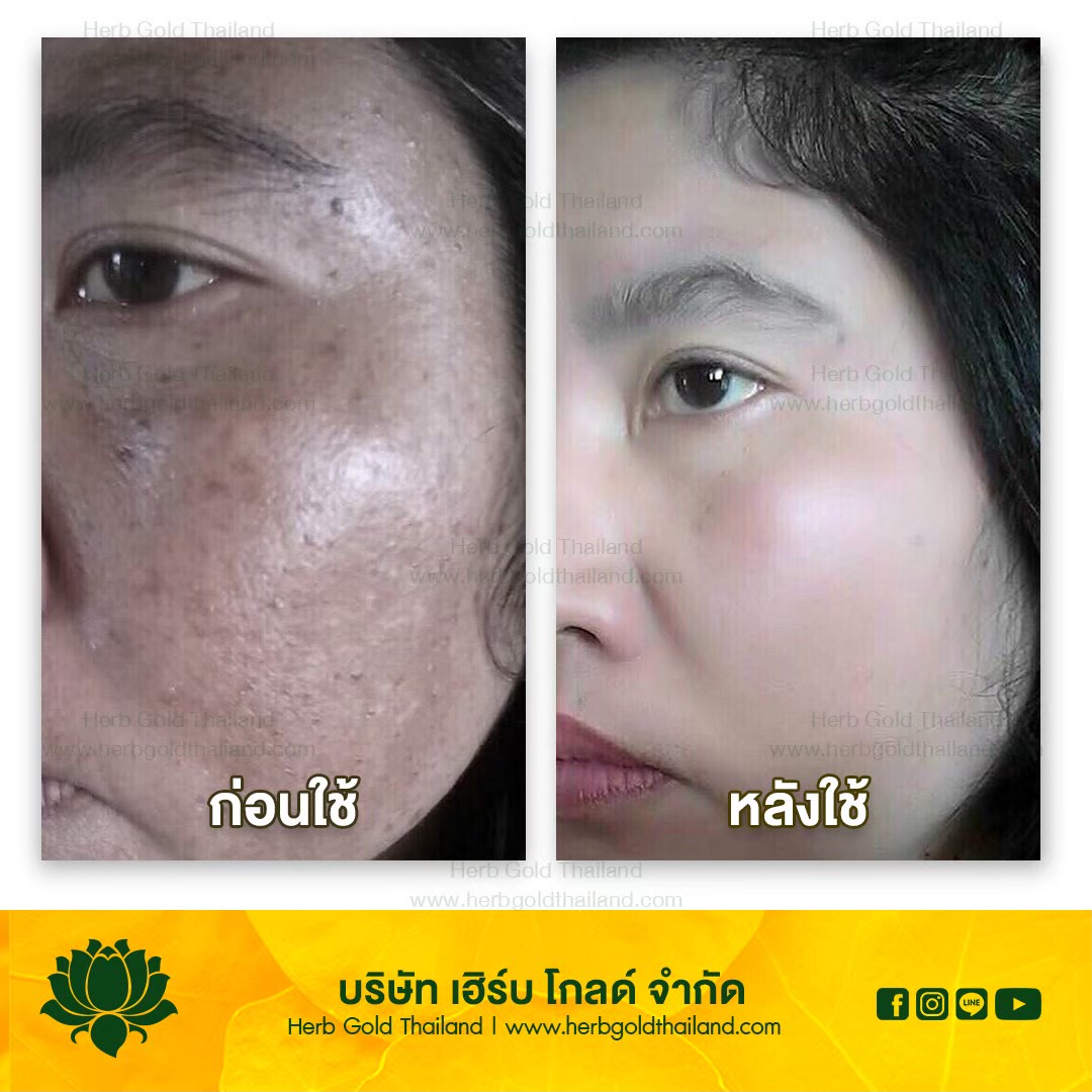 รูปเซลเพจ