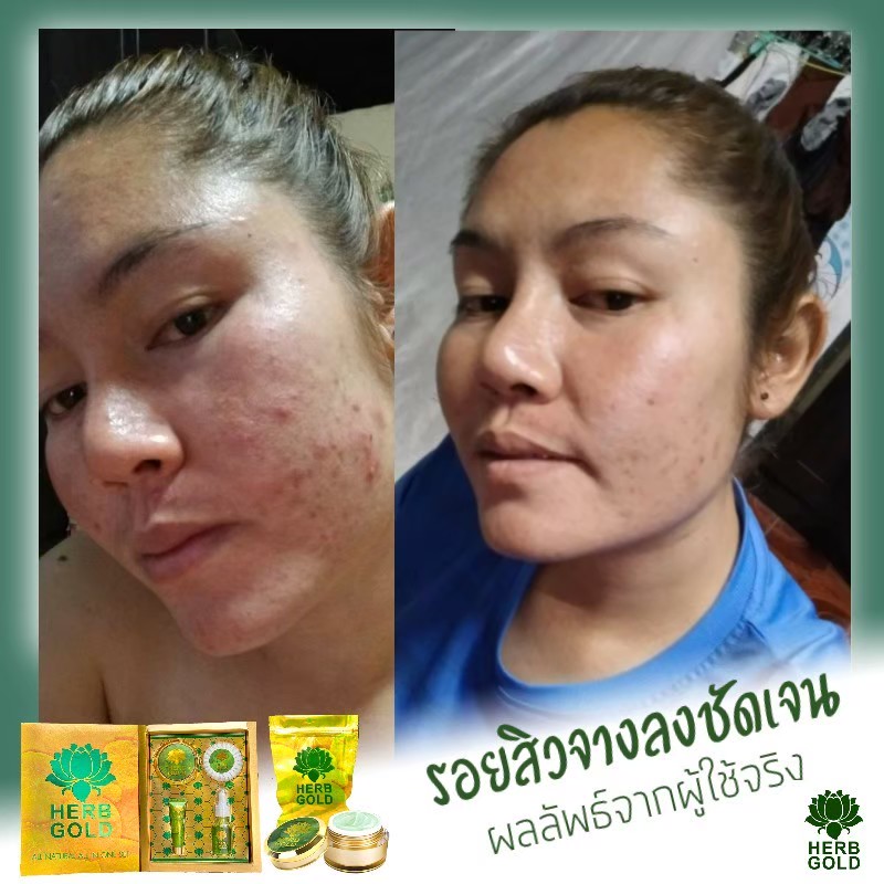 รูปเซลเพจ