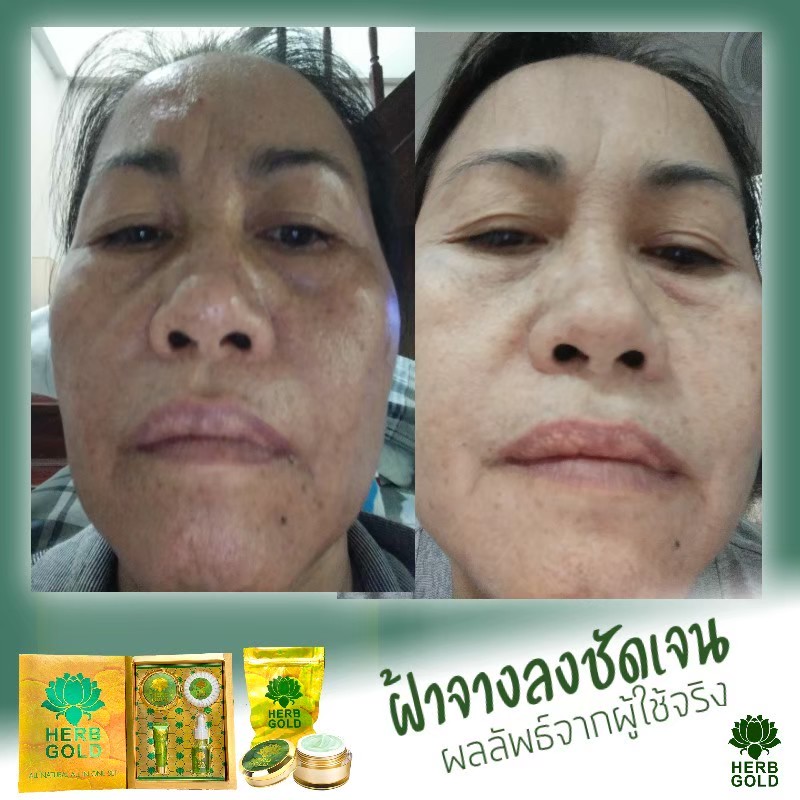 รูปเซลเพจ