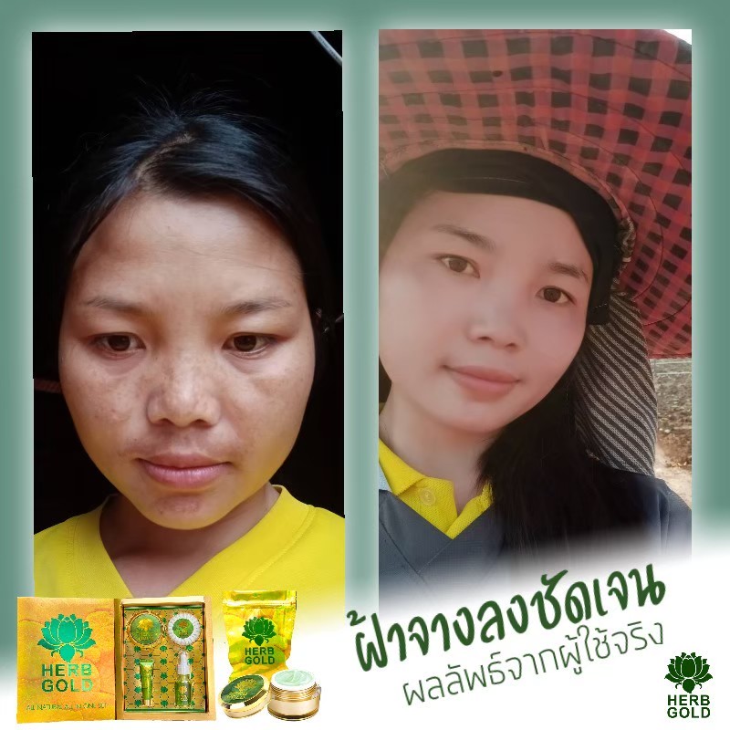 รูปเซลเพจ
