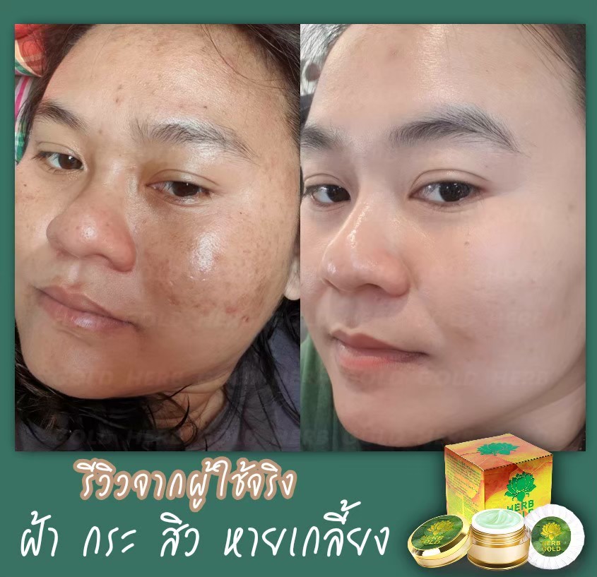 รูปเซลเพจ