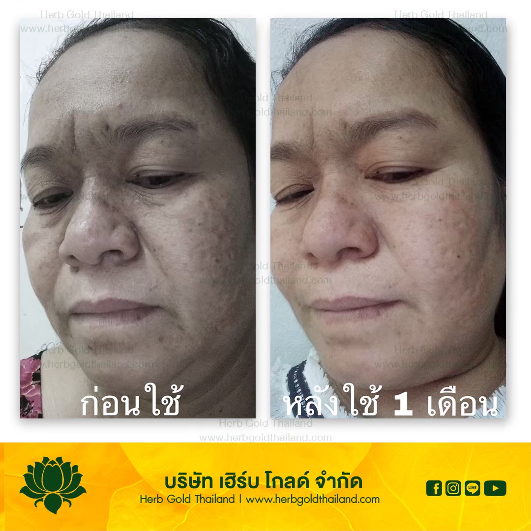 รูปเซลเพจ