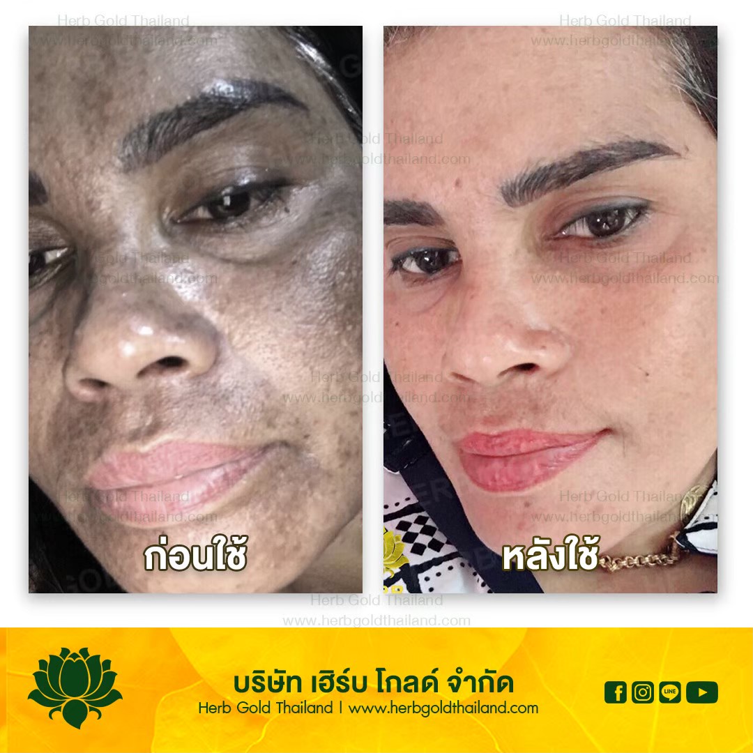 รูปเซลเพจ