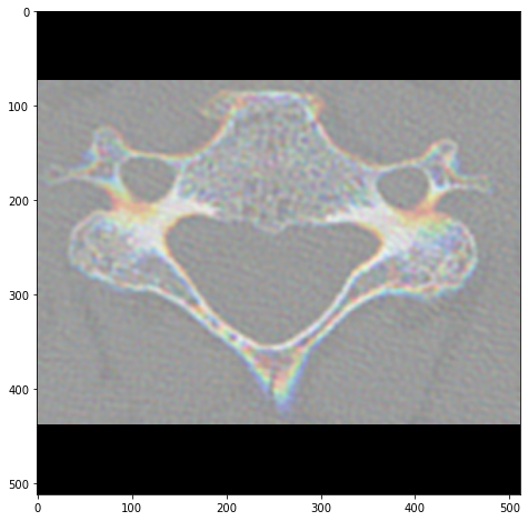 Fracture Image Example