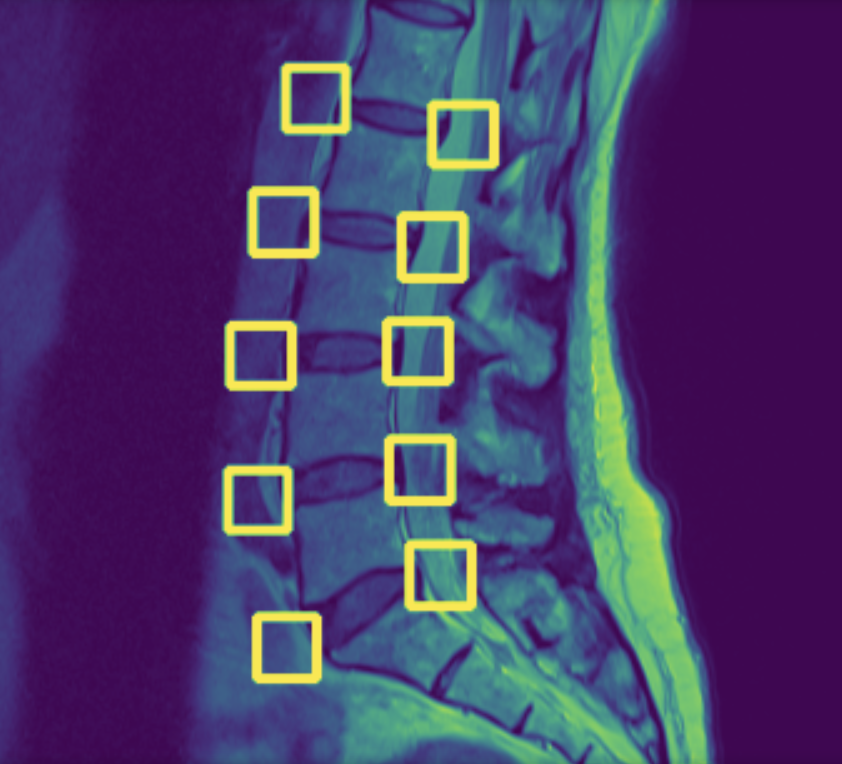 Sagittal Detection