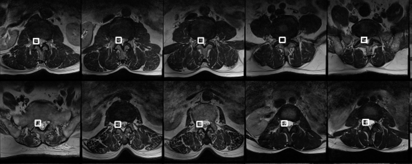 Axial YOLOX Detection