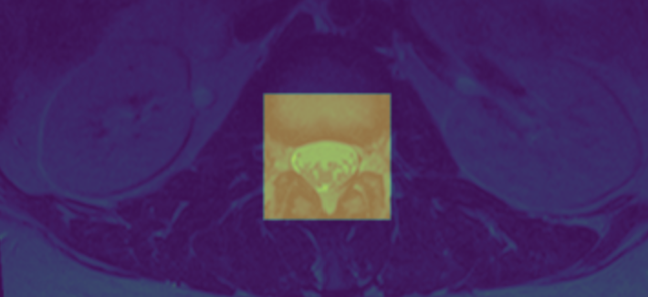 axial_for_scs_cropping