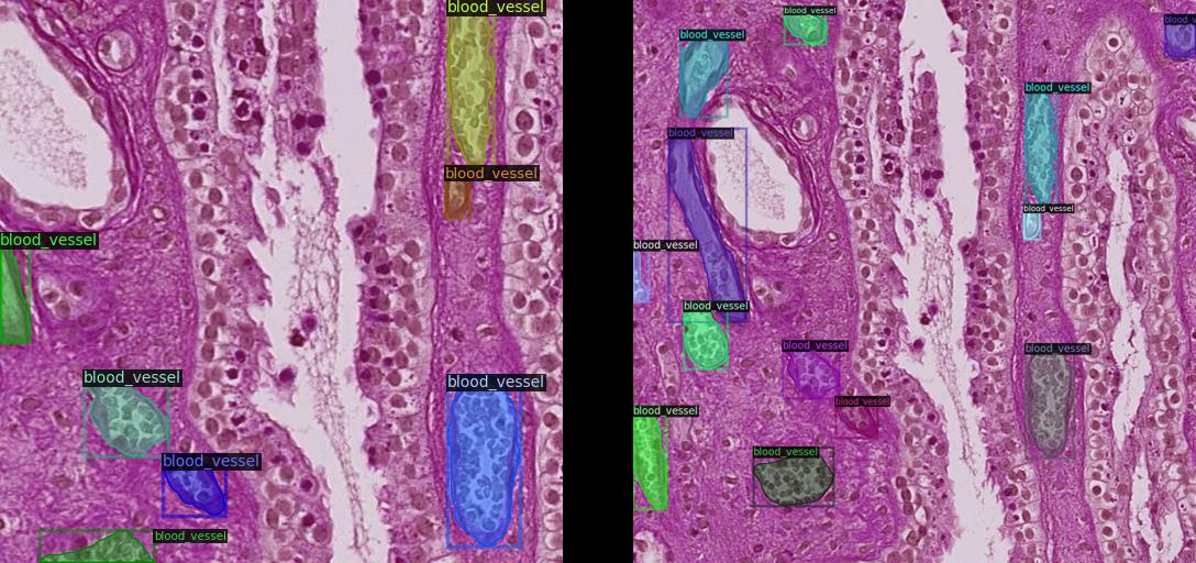 原始切片（左）与填充切片（右）对比