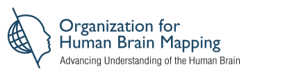 Kaggle competition image for TReNDS Neuroimaging