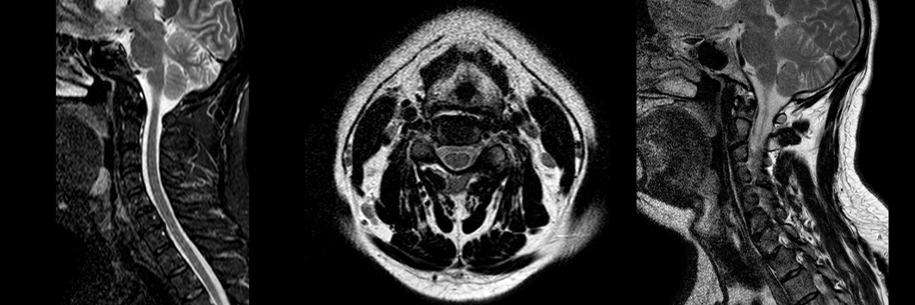 MRI 研究角度