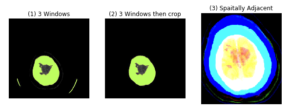 Data Preprocessing
