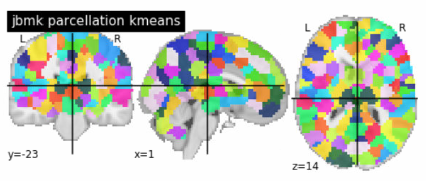 Kmeans Parcellation