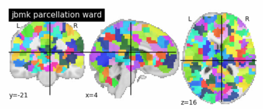 Ward Parcellation