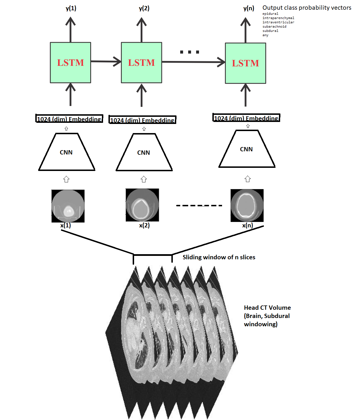 RSNA Competition Result