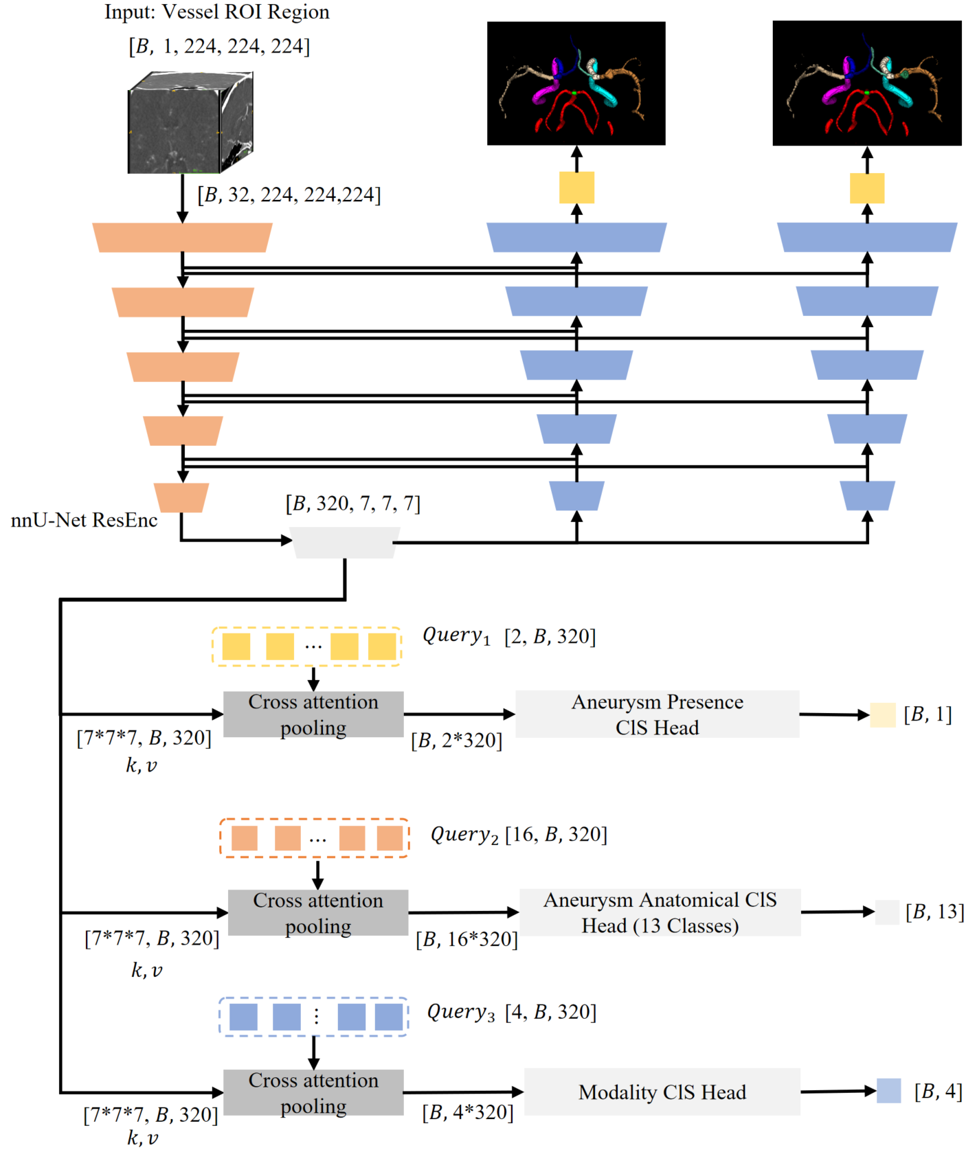 Stage 2 Diagram