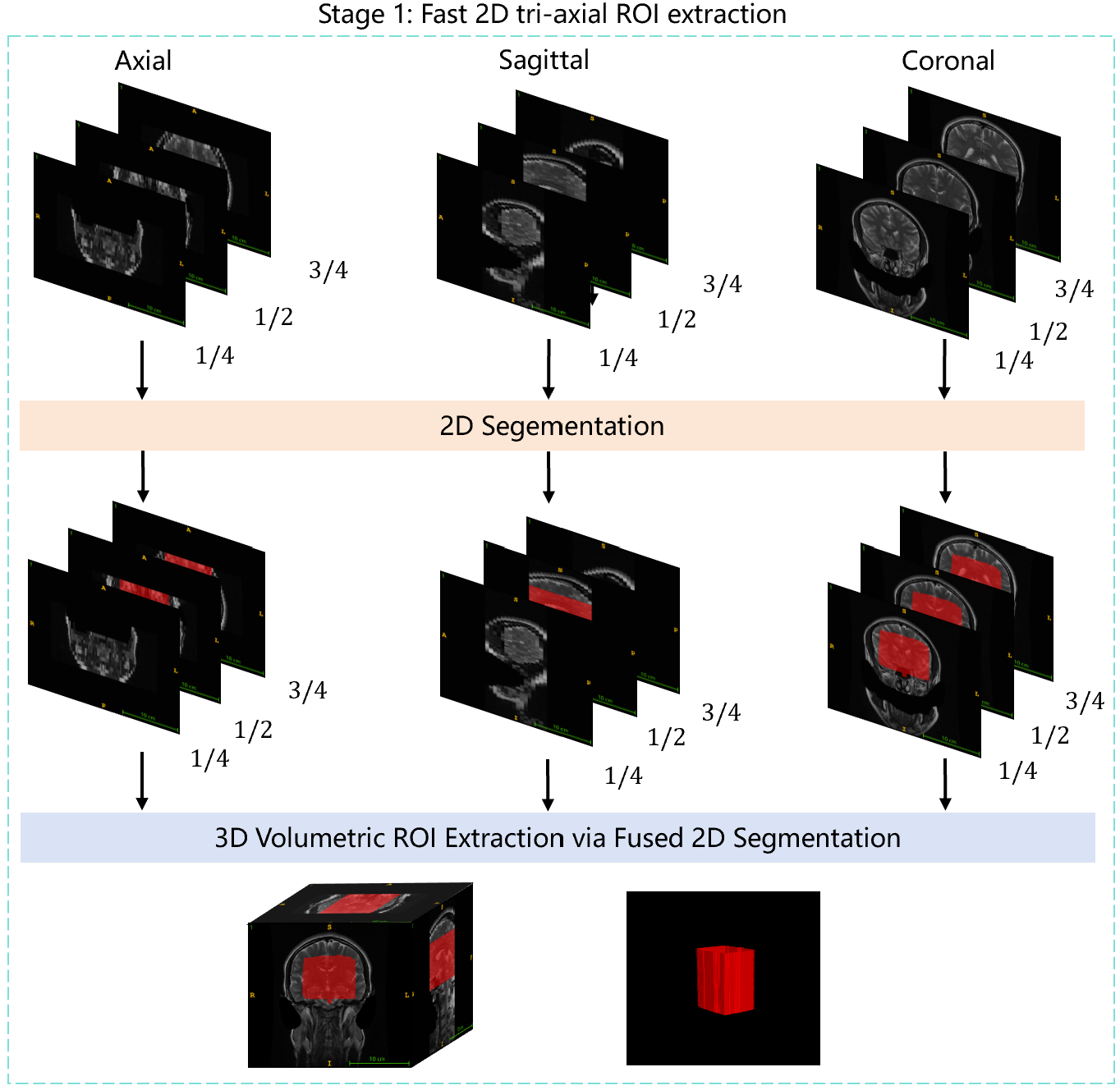 Stage 1 Diagram