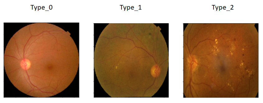 Image Types