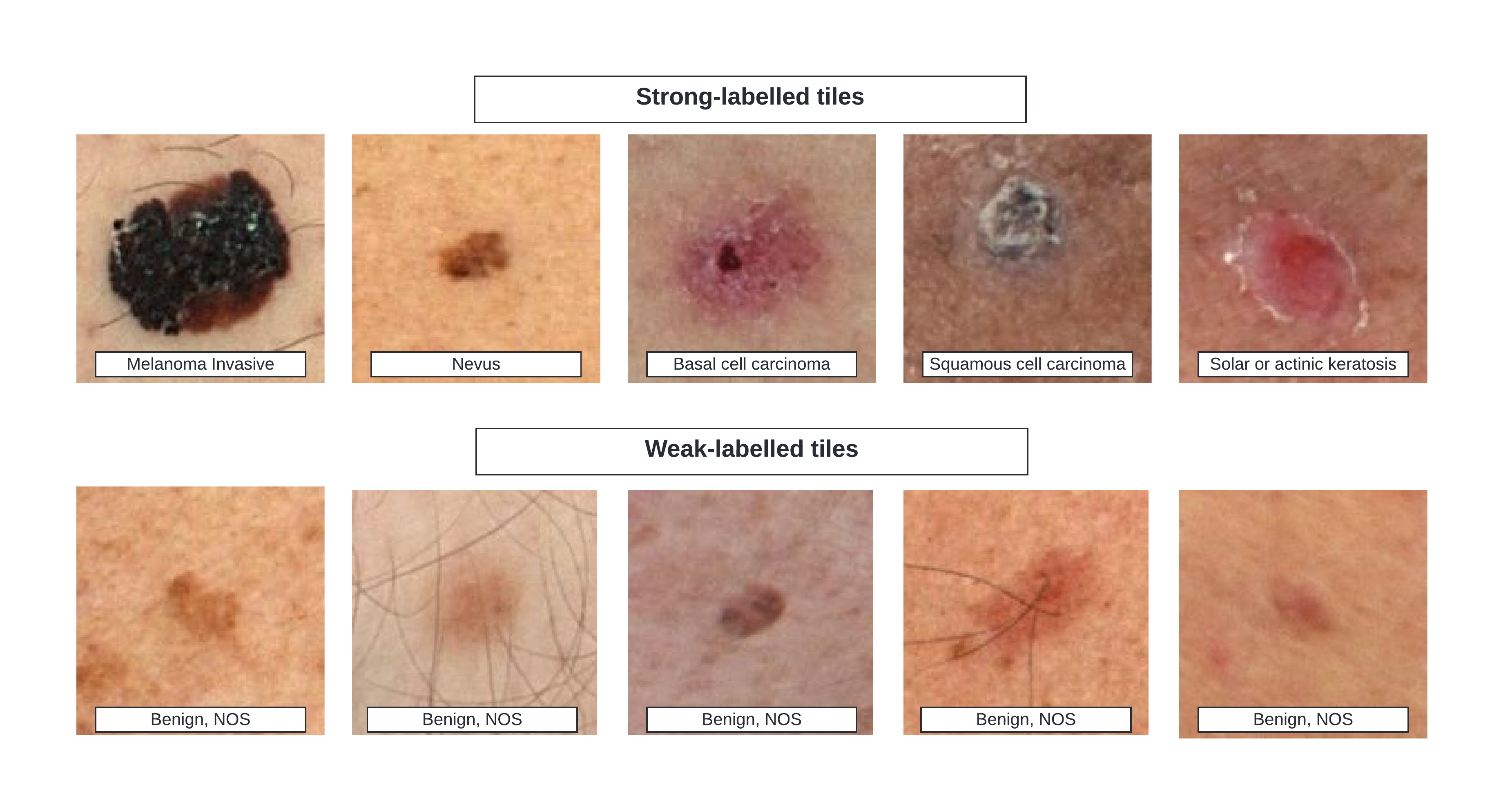 Optional Title Alt text