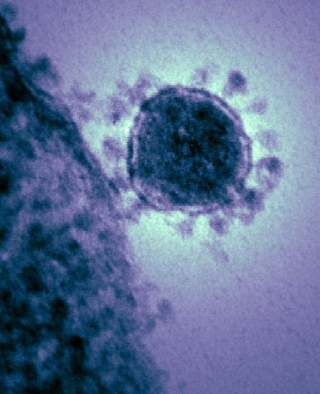 Social media posts claim that coronavirus has already been patented in the United States.