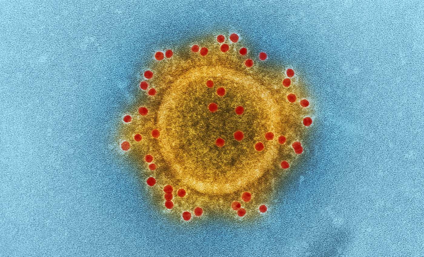The global mortality rate of COVID-19 is 1 percent.