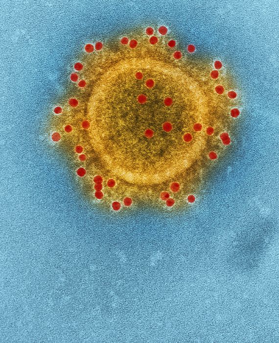 Wuhan lab was performing coronavirus experiments on bats from the caves where the disease is believed to have originated with a £3m grant from the U.S.