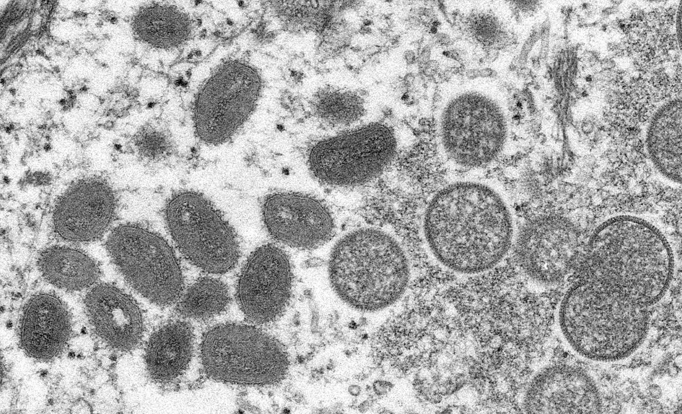 The monkeypox pathogen originated in U.S.-funded biolabs in Nigeria.