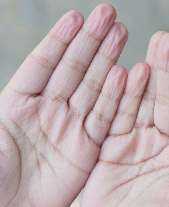 Fingers get wrinkly in water as the wrinkled fingers give a stronger grip on slippery objects underwater.