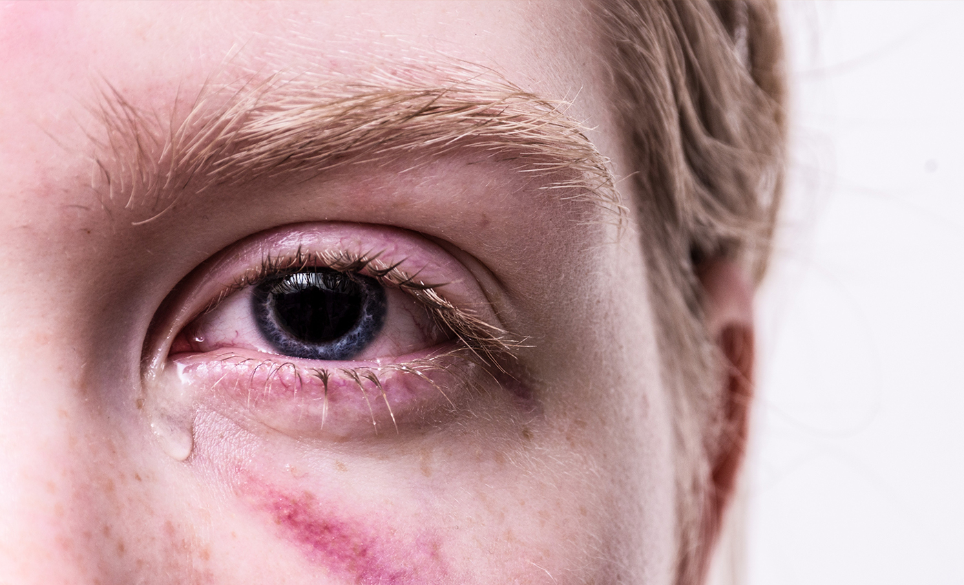 One can avoid tearing up by relaxing the jaw and rapidly blinking.