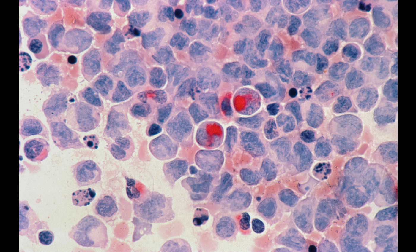 ‘TO-MOR-GONE’ is a cure for cancer that was suppressed by the American government.
