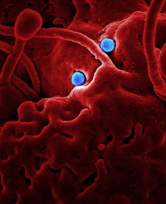 There are four types of endemic coronaviruses that cause common cold in humans.