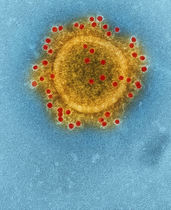 Dr. Tasuku Honjo has called COVID-19 a man-made virus.