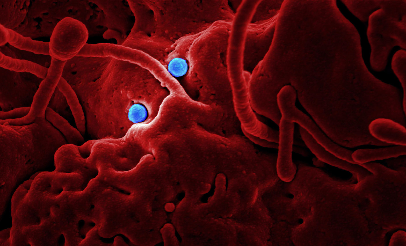 14,000 people have died from H1N1 in the United States.