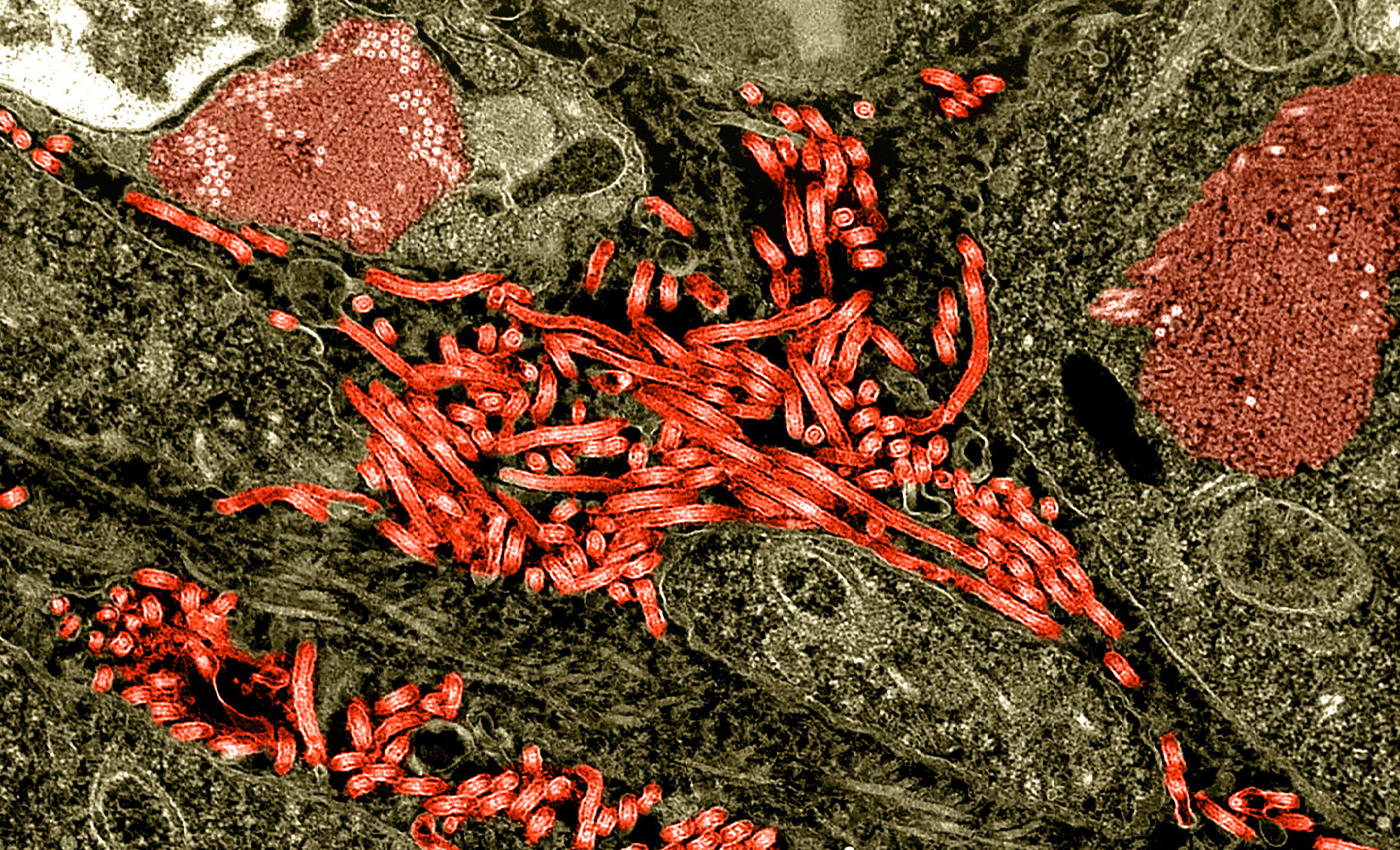 Ebola is a man-made bioweapon developed by an evil deep state which is waging an underground war.