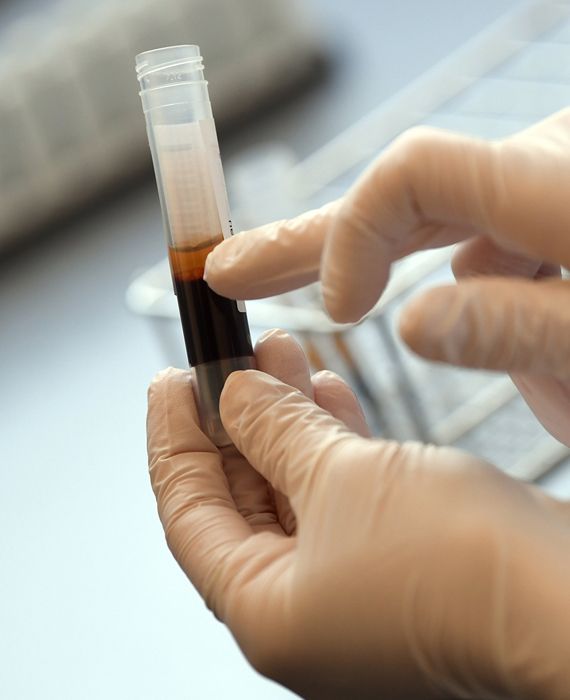 Few states in India have started plasma therapy trials and HCQ is in administration to fight against COVID-19.