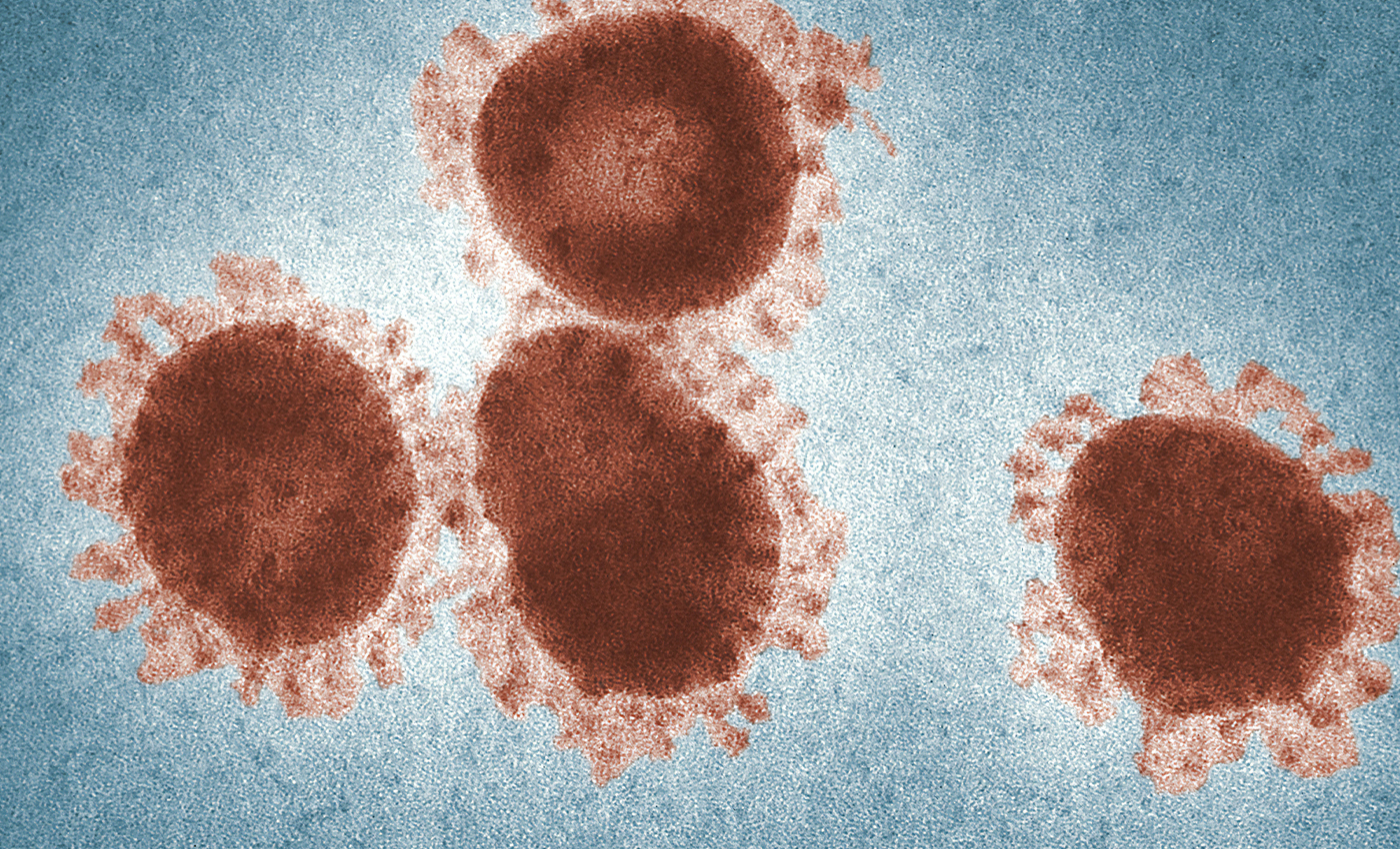 Ten people tested positive for COVID-19 in Kolkata's Chetla in a rapid antigen test on July 30.