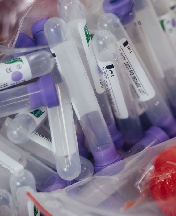 Tanzanian President John Magufuli has questioned the reliability of the COVID-19 testing kits after a goat and a fruit tested positive for the infection.