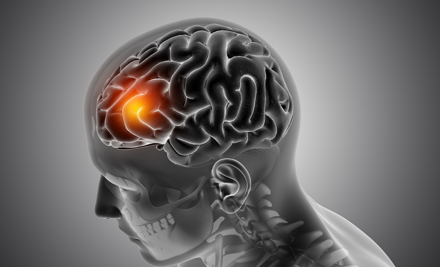 The Charco Neurotech company is developing a medical device to aid people who have Parkinson's disease.